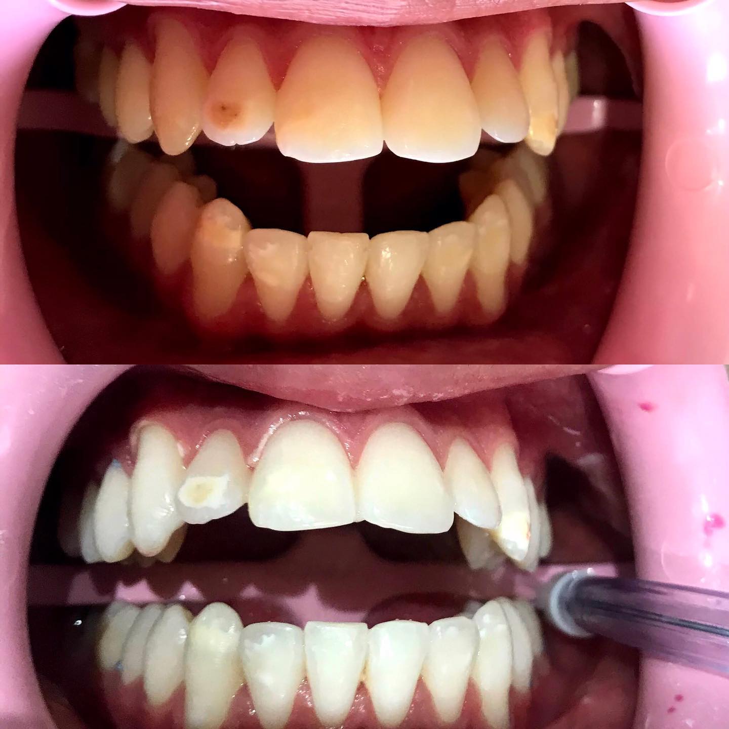 Evolução do Tratamento — antes e depois